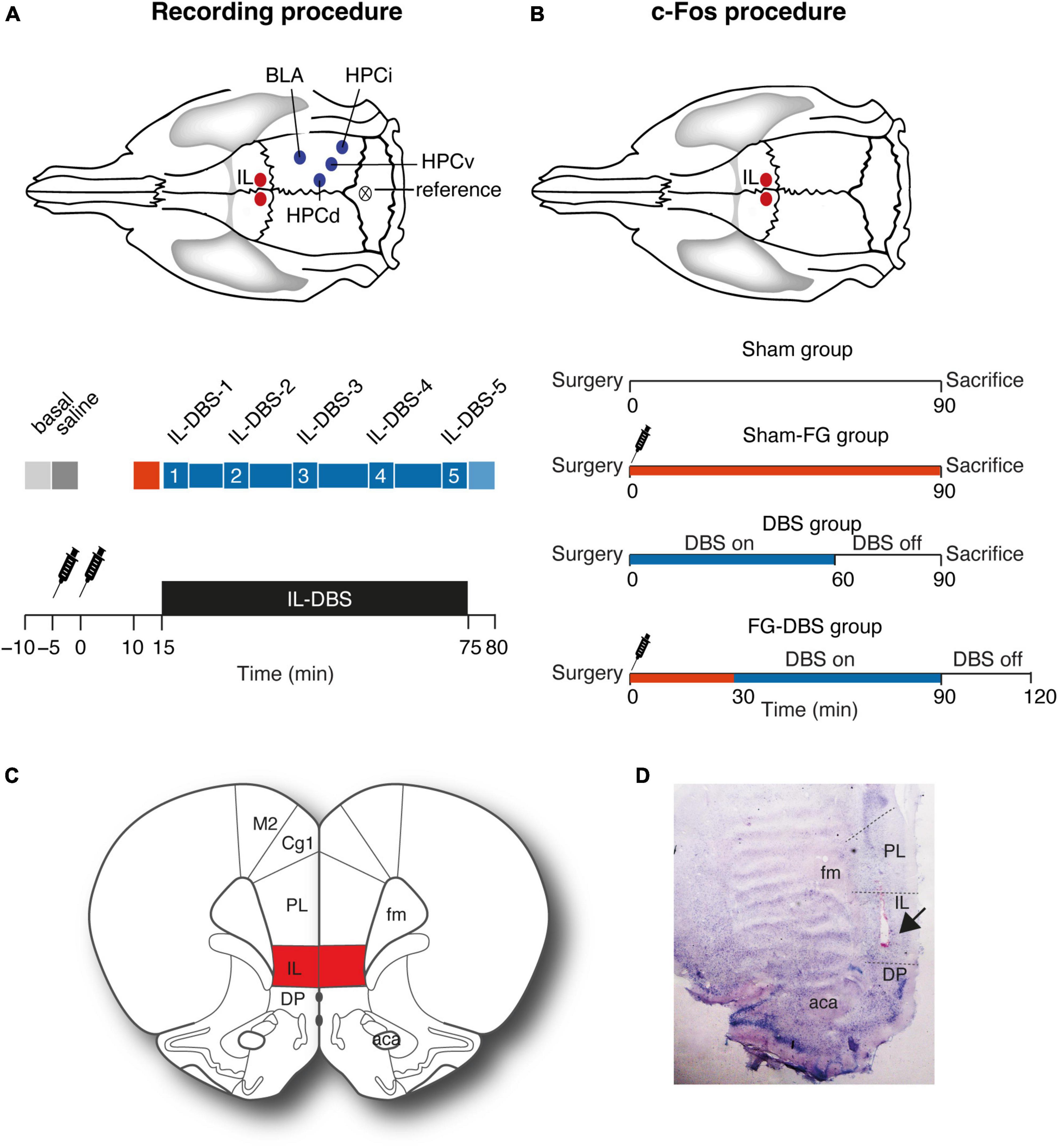 Sex differences in amygdalohippocampal oscillations and neuronal activation in a rodent anxiety model and in response to infralimbic deep brain stimulation